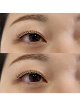 シーディーエム(cdm)/ラッシュカール