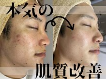 メンズサバス たまプラーザ