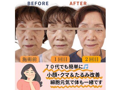 ロータスマップ(LOTUS MAP)の写真