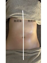 ミーアンドミー(ME and ME)/ME and ME