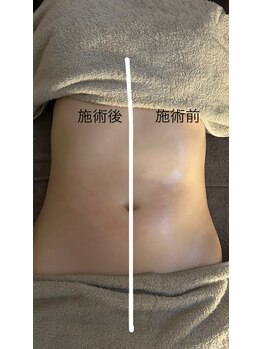 ミーアンドミー(ME and ME)/ME and ME