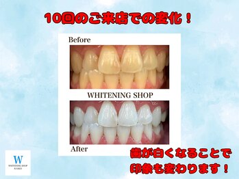 ホワイトニングショップ 名古屋店
