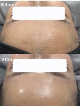 salon結(yui)/ララピール ビフォーアフター