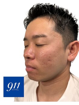 水素ジム911 心斎橋/韓国肌管理*ララピール¥4,800