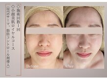 ベラ 東京院(Bella)/一度で得られる即効性も大切に♪