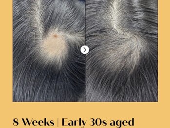 ルーナ 恵比寿(Luna)/ヘアロペーシア