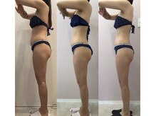 リラパドマ 千葉店(Rela Padma)/激痩せ短期集中ダイエットコース