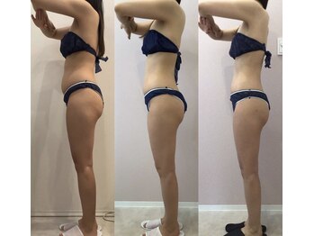 リラパドマ 千葉店(Rela Padma)/激痩せ短期集中ダイエットコース