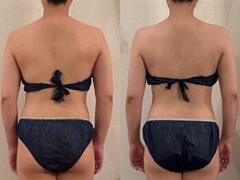 メゾン ドゥ アミ(Maison de Ami)/