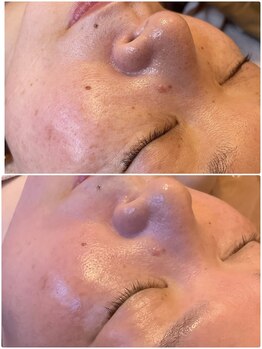 ソル(SOL)/お顔の変化も得意です