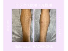 スプランドゥール 八戸(Splendeur)/足脱毛