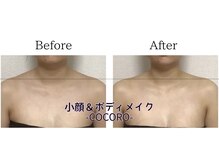 ココロ(COCORO)/ボディコルギ1回