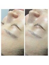 晴(haru)/眉スッキリ