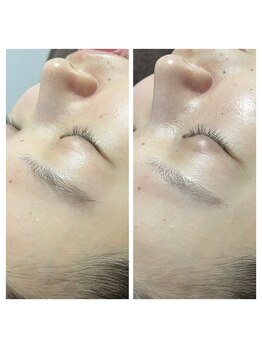 晴(haru)/眉スッキリ