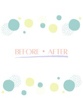 ルポ(Repos.)/ビフォー・アフター