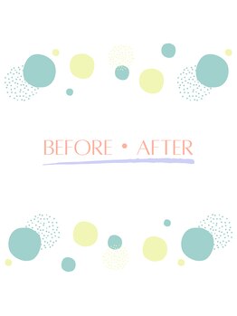 ルポ(Repos.)/ビフォー・アフター