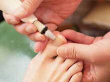 わたなべ接骨院の雰囲気（巻き爪施術前、他にもお気軽にご相談ください）