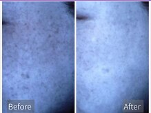 ポレポレ 八尾(polepole.)