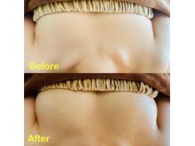 1回で変化を実感♪定期的に受けて頂くと定着していきます。