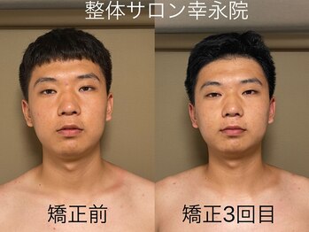 幸永院 川口店の写真/川口【メンズ/小顔】福を呼ぶ顔づくり――あなたの表情が未来を変える完全プライベート院