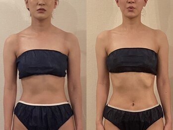 メゾン ドゥ アミ(Maison de Ami)/