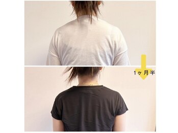 ポノフィット(PONO FIT.)/症例／首、肩、背中