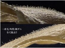 ザ スタイルサロン トーキョー(The Style Salon TOKYO)の雰囲気（人気のフェイスワックス。目に見えない産毛までしっかりキャッチ）