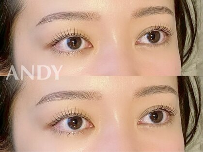 アンディ(ANDY)の写真