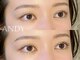 アンディ(ANDY)の写真