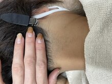 ナノハナ/鹿沼市全身脱毛美容室ナノハナ