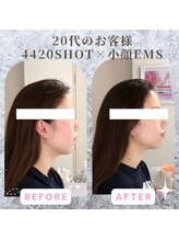 ラ セラフィータ 中目黒/【上級小顔】EMS美容液導入付き
