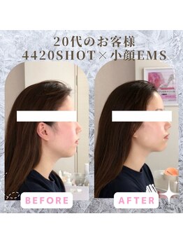 ラ セラフィータ 中目黒/【上級小顔】EMS美容液導入付き