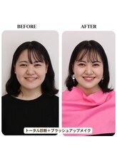 シュアリー(Surely)/トータルコースお客様事例