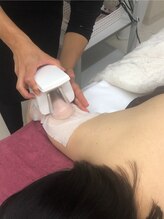 ラフレーズ 名駅店/二の腕