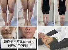 ビモテ 博多(bimote.)の雰囲気（ブライダル◎目周り・毛穴・フェイスライン・O脚・頭の大きさも!）