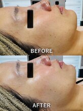 ルーク(Luke)/くすみケア