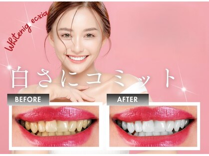 エクシアホワイトニング 調布店の写真