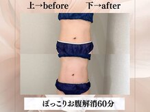 イヨヨ(iyoyo)/【痩身】Before After