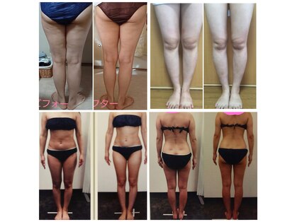 セルビューティー(Cell Beauty)の写真