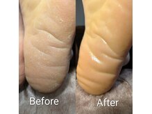 プレヴナンス(Prevenance)