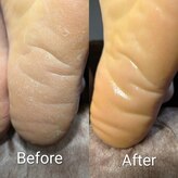 プレヴナンス(Prevenance)