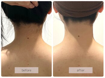 リバース(Rebirth)/プロにお任せください◎