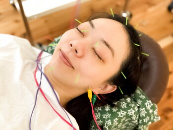 鍼灸整骨院 イーアス(E'as)の写真/顔だけじゃない！頭皮にもしっかりアプローチする美容鍼。たるみの天敵「重力」を徹底解放！ヘッドスパ付き