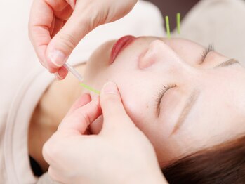 ニワトコ 与野駅前院(niwatoco)/初回の方でも受けやすい♪