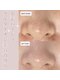 ベル(Belle)の写真/《つるんつるん☆ツヤ肌爆誕！》角栓・ざらつきが気になる方に◎【水素ハイドラフェイシャル】