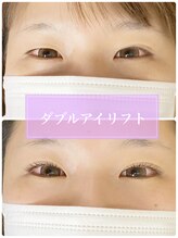 アグライア(Aglaia)/｢SNSで話題の｣ダブルアイリフト