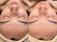 ブレデサガ(B’lady Saga)/一度のケアでもトーンアップ☆