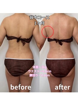 リリー(Lily)/背中コース