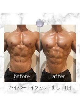 ノドカ 熊本駅前店(NODOKA)/カット出しbefore→after