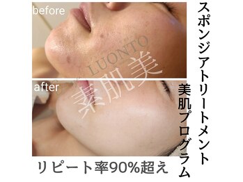 ルオント(LUONTO)